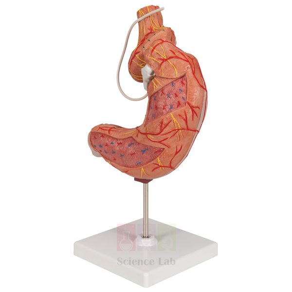 Gastric Band Model